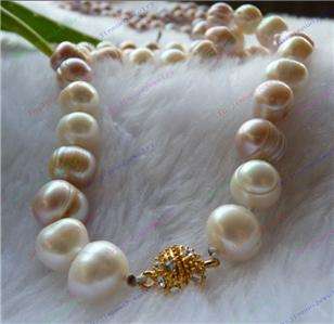 Cool Big Pink&White 8 9mm Sea Akoya Pearl Necklace 32  