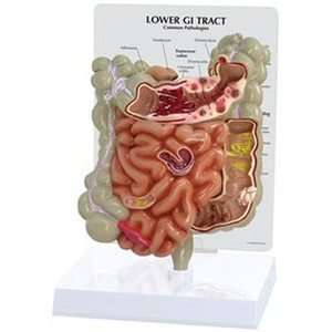 Lower GI Tract Human Anatomy/Anatomical Model #3342  